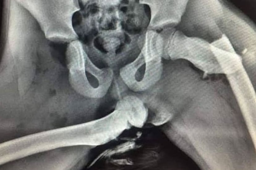 4 Sebab Mengapa Anda Tidak Patut Meletakkan Kaki Anda di Papan Pemuka!, photo 2